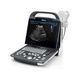 Ultrasonido Portátil para uso Humano DP20 con 3 Transductores Convexo, Endocavitario y Lineal + Doppler Power