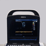 Ultrasonido Portátil para uso Humano DP20 con 3 Transductores Convexo, Endocavitario y Lineal + Doppler Power