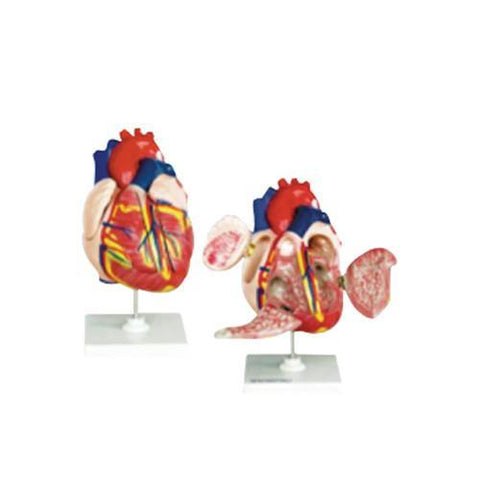 Modelo Corazón Mediano