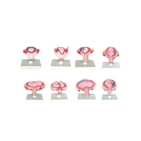 Modelo de las 8  Etapas del Embarazo