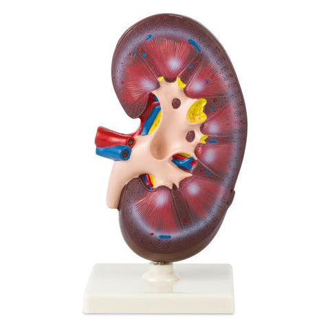 Modelo del Riñon Grande