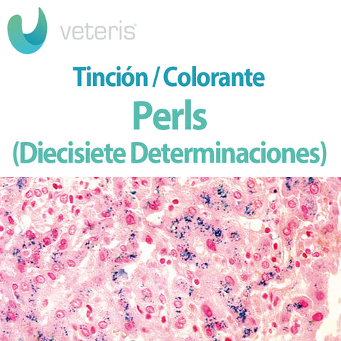 Tinción de Perls 17 Determinaciones