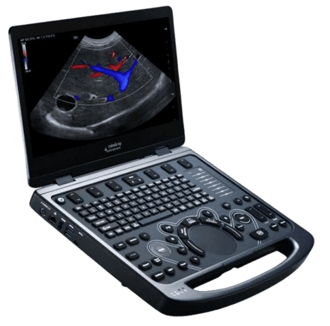 Ultrasonido Portátil Veterinario Vetus E3 ADVANCED
